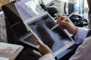 Female doctor hand holding digital tablet with chest x-ray